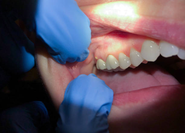 Best Emergency Denture Repair in Minneota, MN